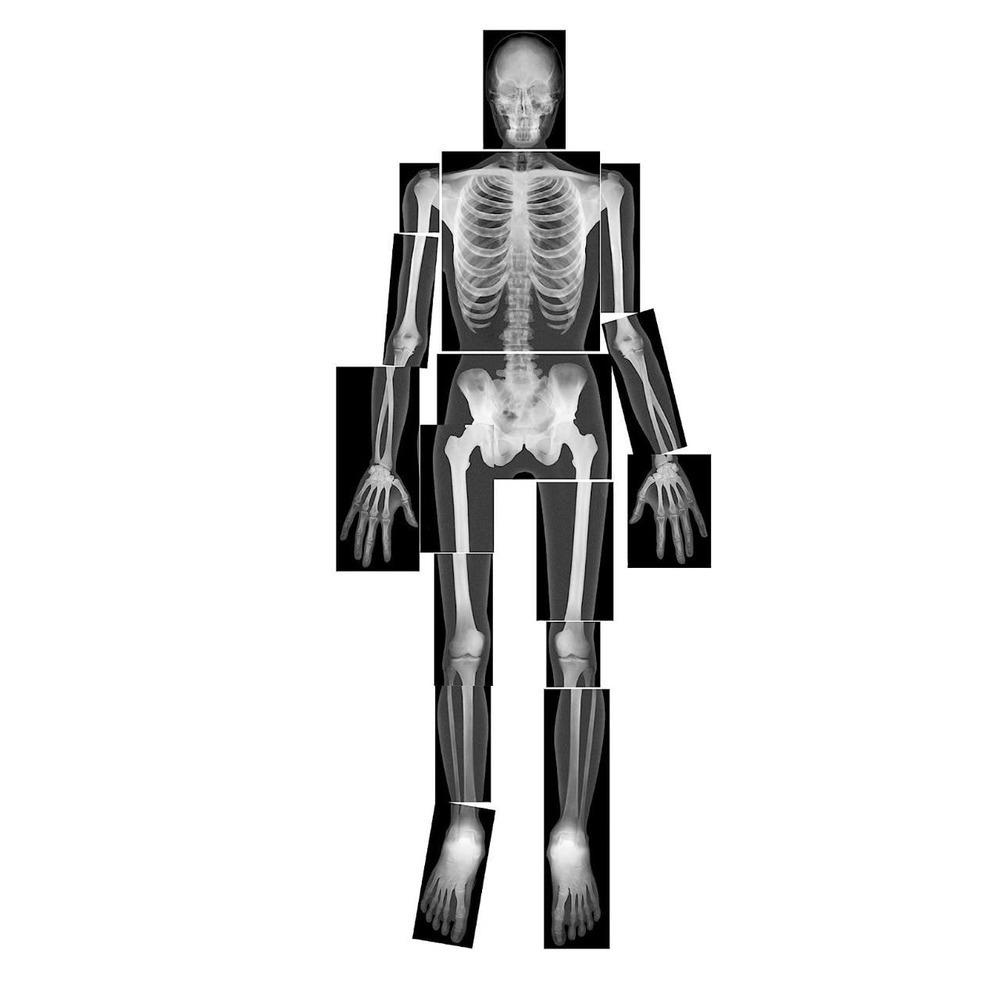 New Roylco Human Body X-Rays Montessori Learning Elementary Education